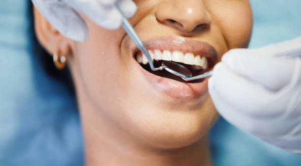 Best Emergency Treatment for Dental Infections or Abscesses in Chattahoochee Hills, GA