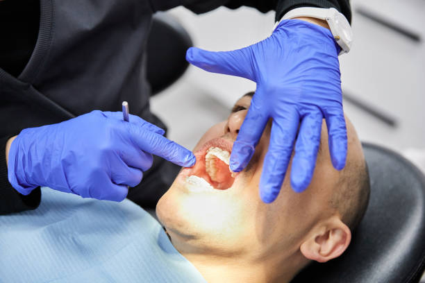 Best Emergency Tooth Extraction in Chattahoochee Hills, GA